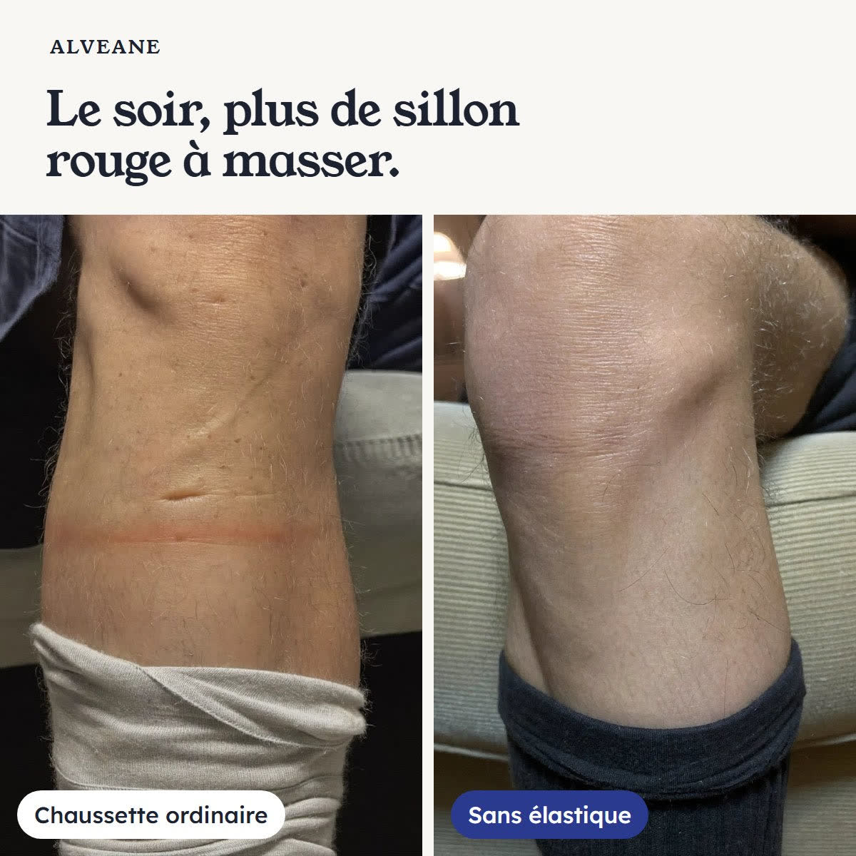 Le soir, plus de sillon rouge à masser : la marque d'une chaussette ordinaire, à côté d'une jambe sans marque après la chaussette sans élastique.